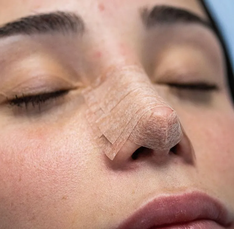 Reconstrucción nasal